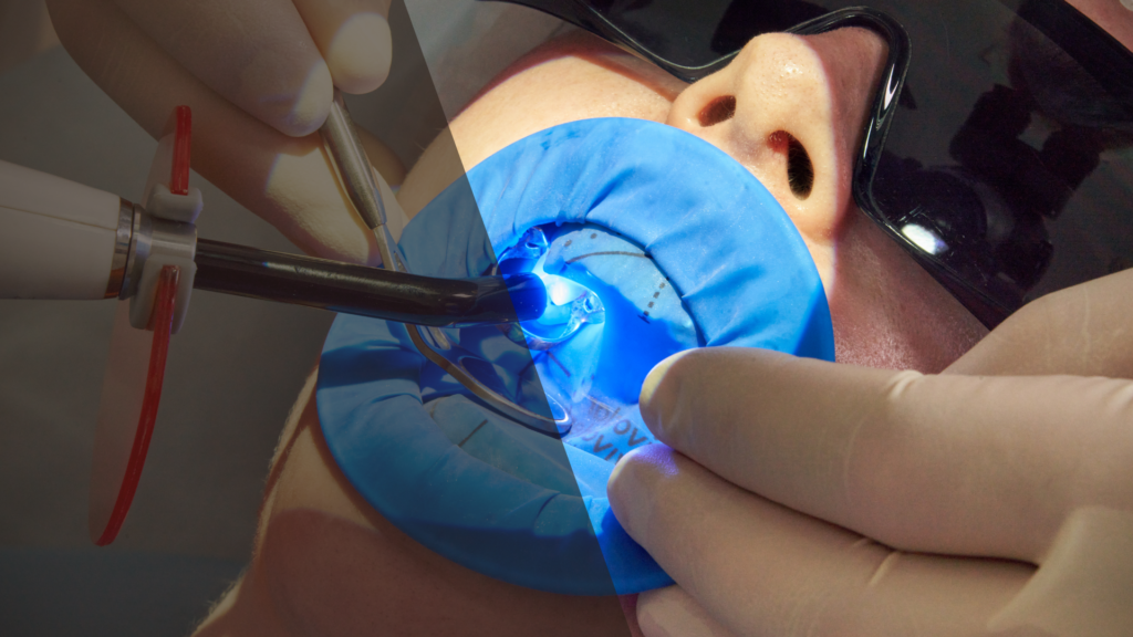 dolgu-tedavisi - Marjinal Dent - İzmit ve Kocaeli Diş Kliniği - Marjinal Dent - İzmit Ve Kocaeli Diş Kliniği